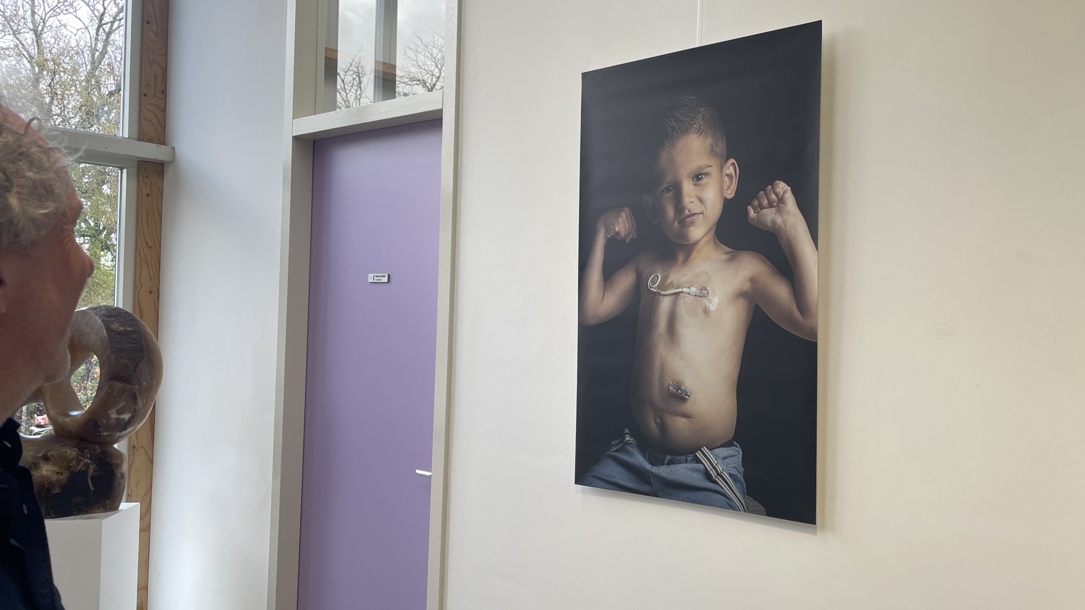 Een man kijkt naar een kunstfoto van een kind met ontblote borst, buigende armen en medische pleisters, opgehangen in een galerie met paarse deur.