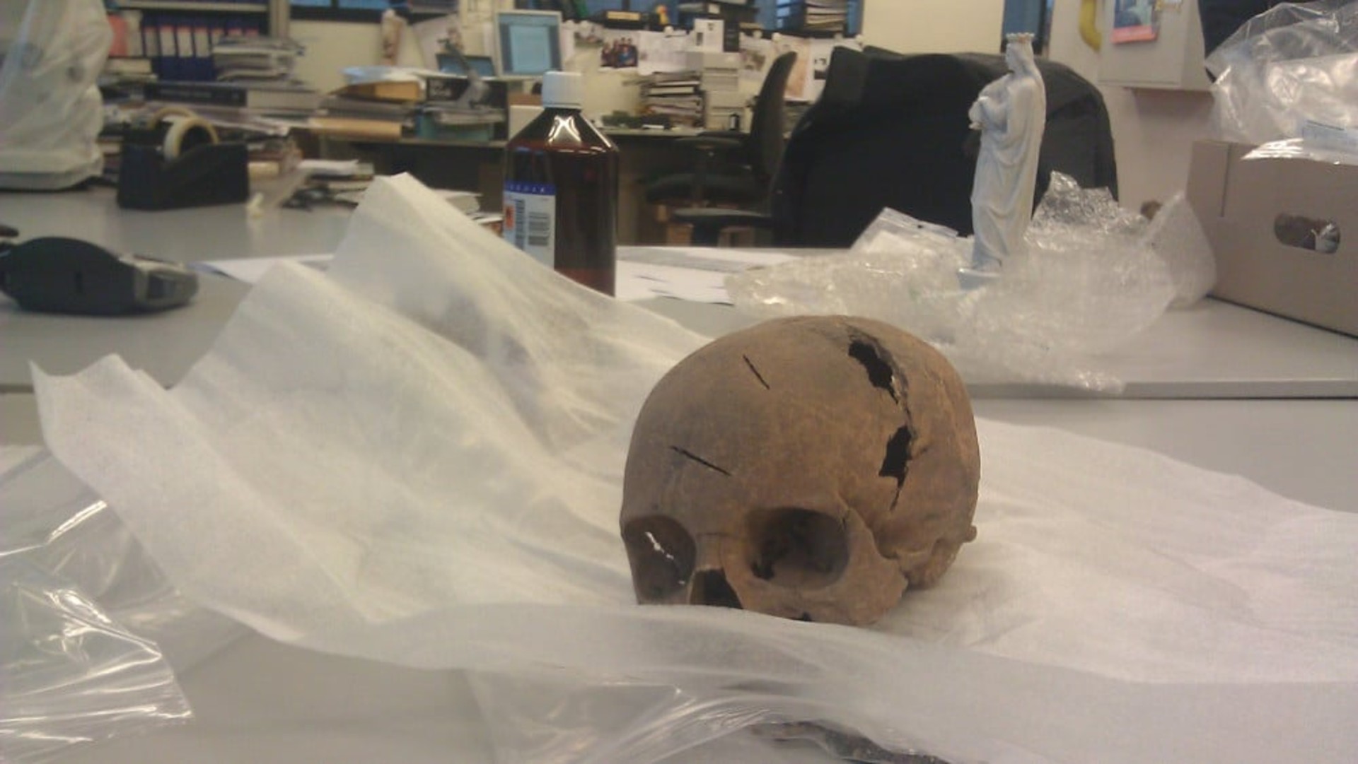 Een schedel met breuken ligt op doek in een kantoorachtige omgeving met boeken en een flesje in de achtergrond.